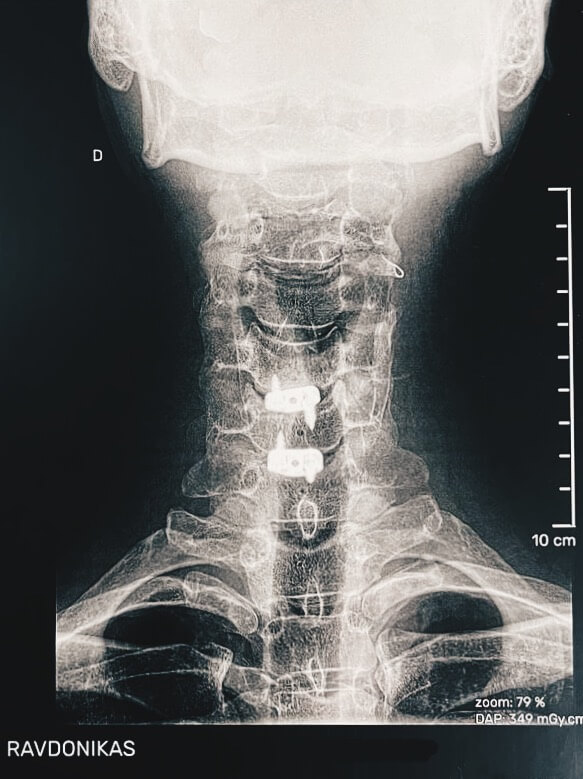 If your eyes could shoot x-rays, you would see me like this.